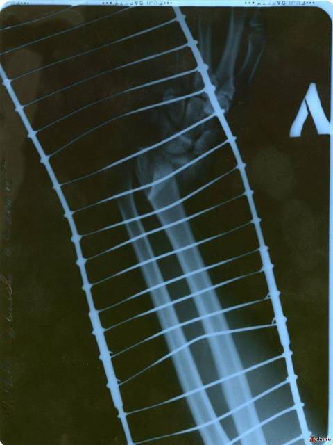 �������, ����� ���������� � ������ ������